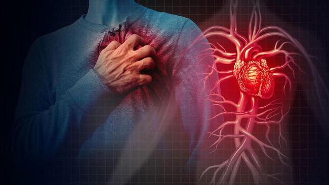 ilustrasi-sakit-jantung-akibat-tersumbat-pembuluh-darah-istockphotowildpixel_169